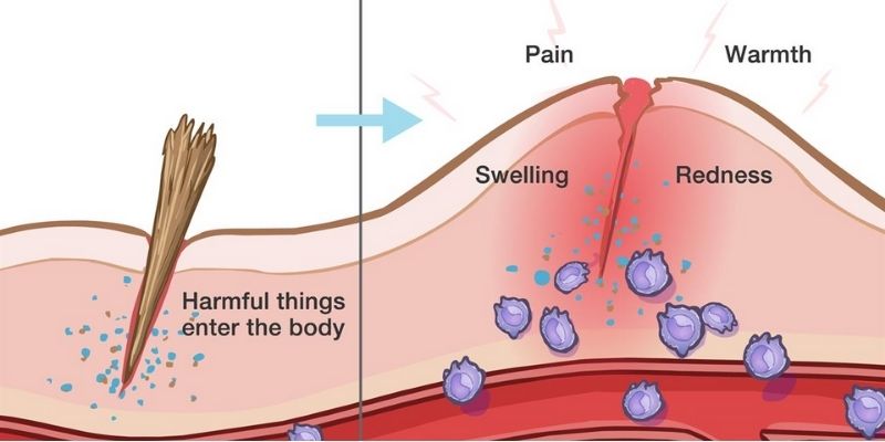 reduce inflammation