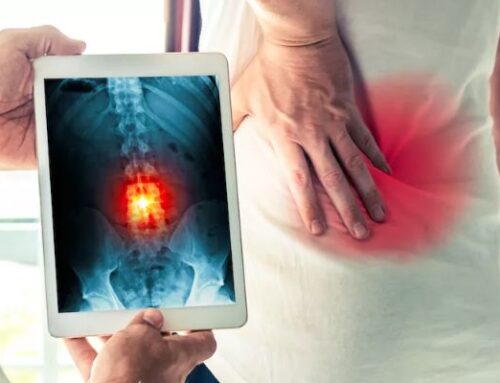 The Essential Role Of X-Rays In Ensuring Safe And Effective Chiropractic Care