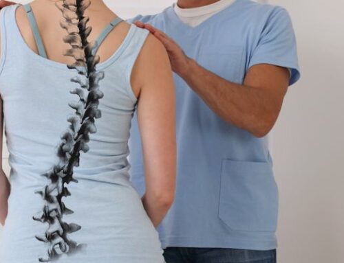Managing Scoliosis with Chiropractic Care: Exploring Non-Invasive Solutions for Long-Term Relief