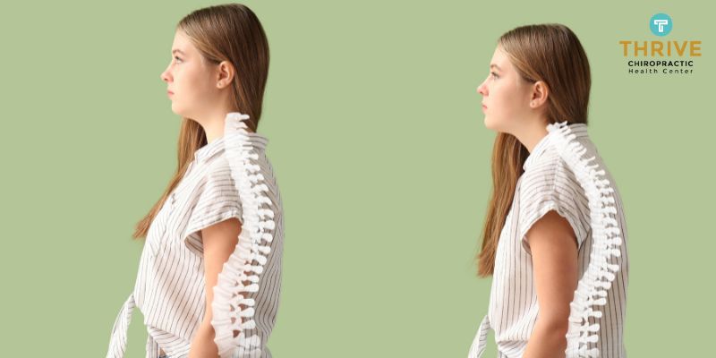 Postural Correction Postural Correction