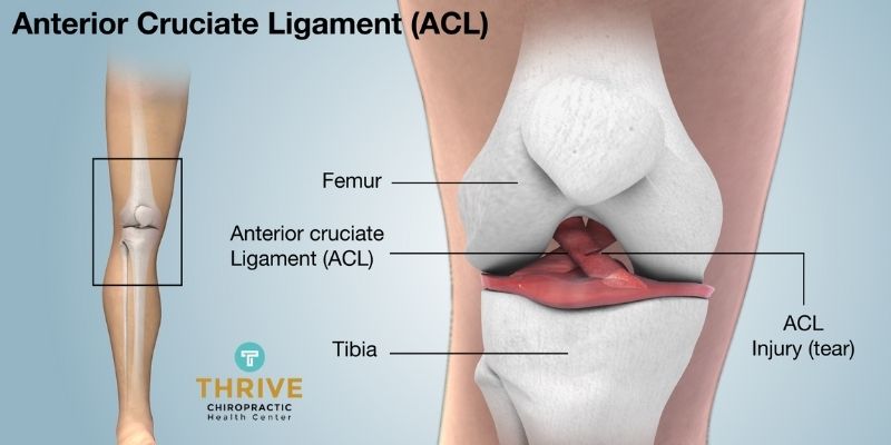 What Do We Mean By ACL Injury_