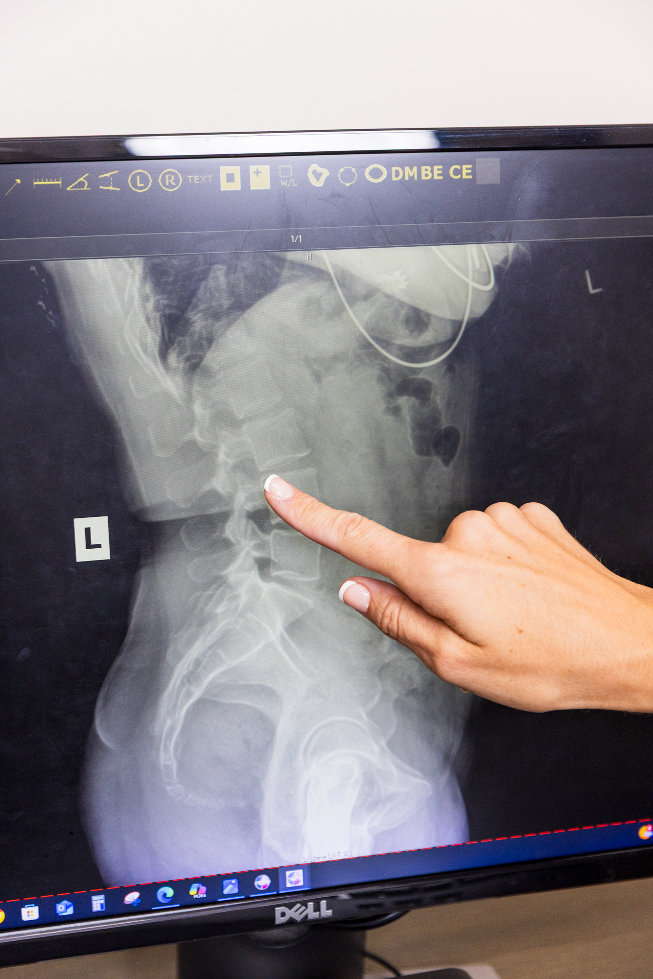 Chiropractor X-Rays in Jacksonville | Thrive Health Center